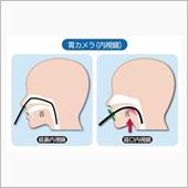 いえんとはいえん