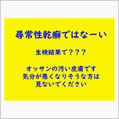類乾癬？？、生検結果も中途半 ...