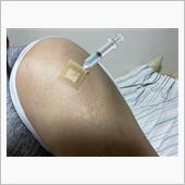 今日はF注入の日💉