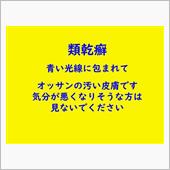 類乾癬です。ブルーの光に包ま ...