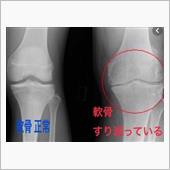 すり減りmonth　（_ _