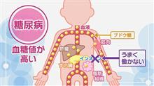 この度、糖尿病の治療を始めました