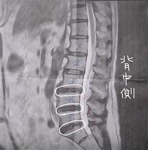 今日は休んで病院へ…😩
