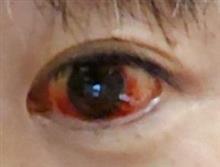 とっくに目は消えとった。